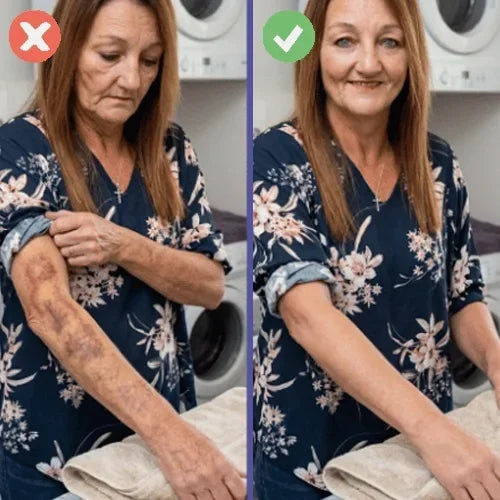 BlåCare™  Minskar blåmärken och hjälper huden att återfå sin fasthet inom 24 timmar.
