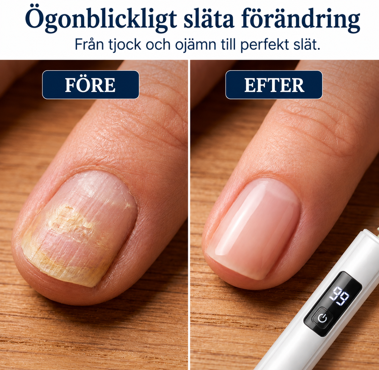 🎉 REA 2026 – 50 % rabatt på vår professionella elektriska nagelfil med 99 hastigheter!